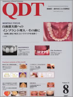 QDT8